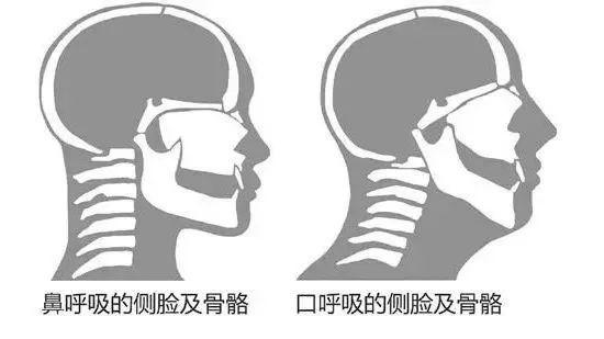 可怕！走路吃饭有这个习惯的女生，真的会越来越丑……