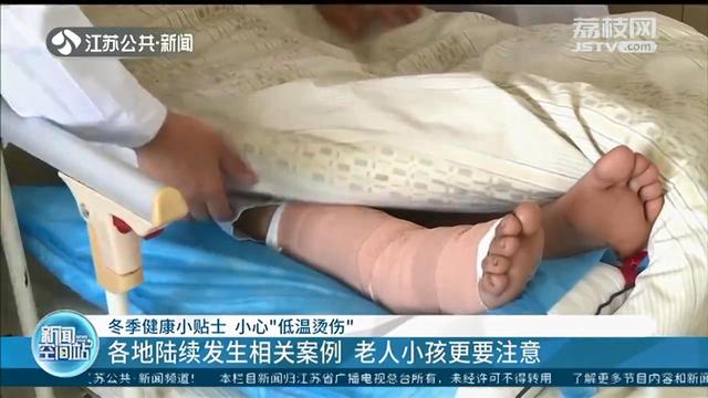 冬季小心“低温烫伤”：发现红肿迅速冷敷 出现溃烂及时就医