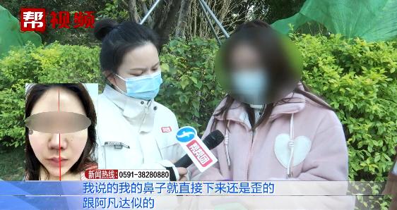 女子花万元做隆鼻手术，术后鼻子却越来越歪：像阿凡达一样