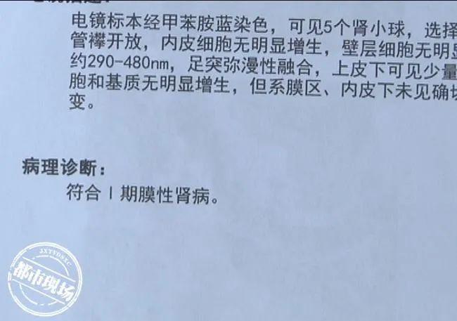 网购护肤品汞超标致花季少女得肾病？厂家、卖家却都不认