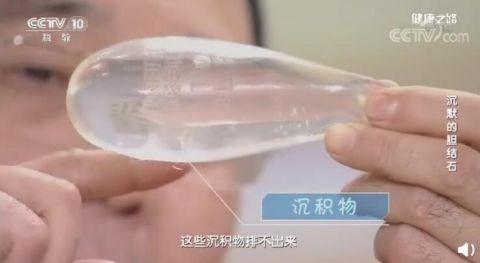 不吃早餐到底有多不健康？经常饿一顿或引发胆结石