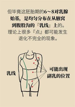 副乳也会得乳腺癌？关于它你了解多少