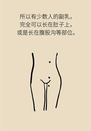 副乳也会得乳腺癌？关于它你了解多少