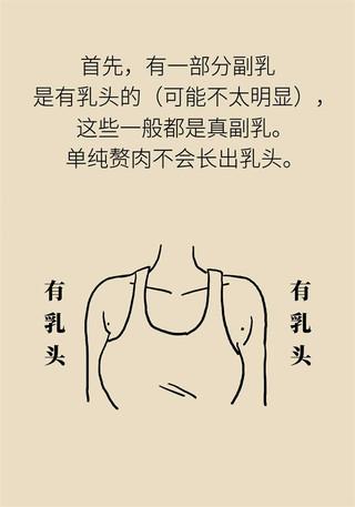 副乳也会得乳腺癌？关于它你了解多少