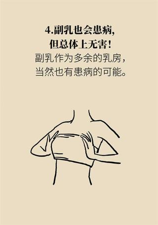 副乳也会得乳腺癌？关于它你了解多少