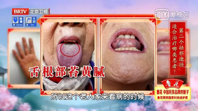 脏腑失调，手上会有这些表现！沈氏女科调理方，帮您祛痰、通大便