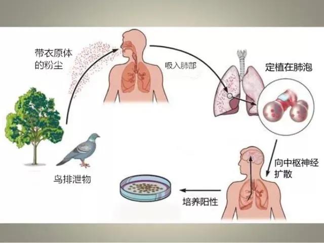 养了几只鸡，却把老人“弄疯”了？72岁大叔肺炎高热不退、精神失常，都是鸡“惹的祸”