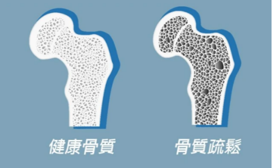 补骨“扛把子”被发现，并非牛奶，医生：敞开吃，助你脆骨变铁骨