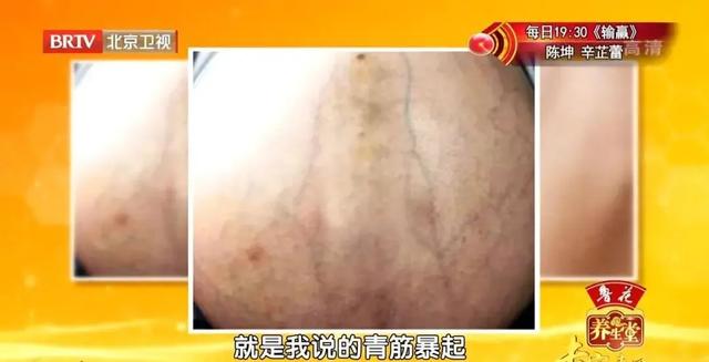 乳房上长肿瘤，10天长到20斤！自查方法，女生一定要掌握