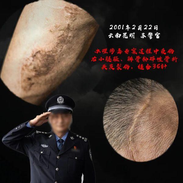 警察节特辑｜不能忘却的伤痕