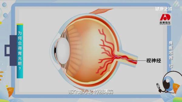 白内障、青光眼、眼底病，小心它们“偷”走你的光明！｜健康之路