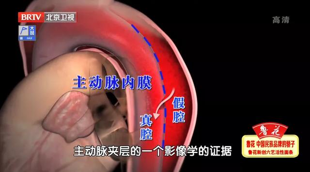 胸痛不一定是冠心病，可能更要命！抓住这3个区别，关键时能救命