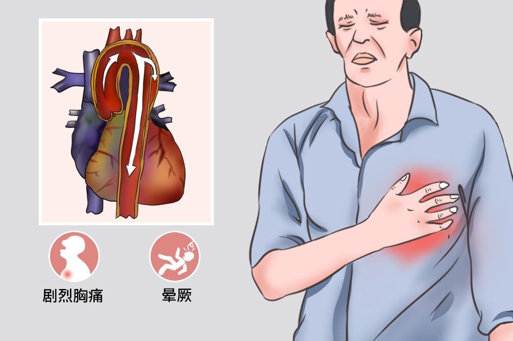 男子突发胸痛，超声“探案”排查“幕后元凶”