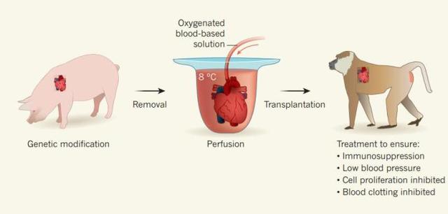 天目Tech+猪心脏移植到患者身上？心脏外科专家：意义重大