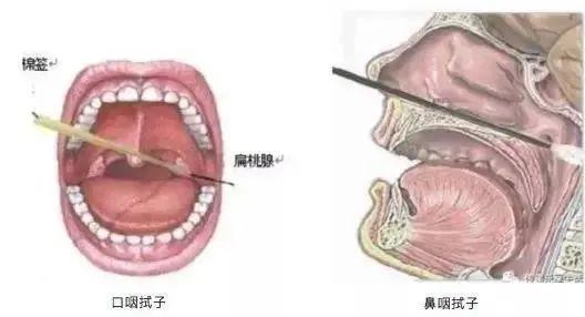 疫情通报怎么看？确诊病例、核酸检测呈阳性有何区别？