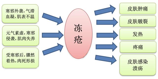 @普陀人，湿冷攻击来了！要是得了冻疮怎么办？