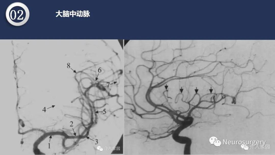 头颈动脉系统解剖