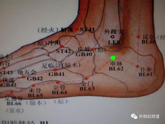 拿什么拯救你，顽固的肩周炎？针刺申脉穴试试看