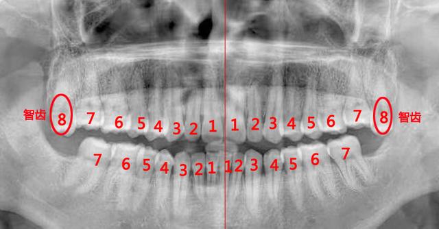人为什么会长智齿？关于智齿你了解多少？