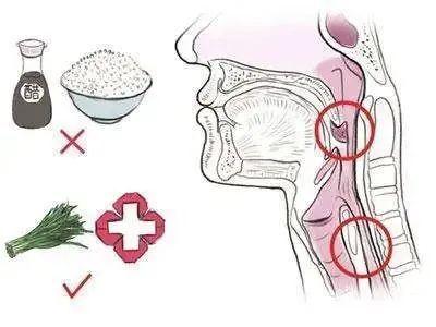 惊 | 一顿饭，让大叔咳嗽，胸痛两年，检查发现左侧气管内还有个闪闪发光的东西...