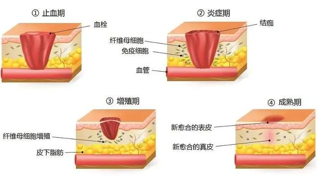 小磕小碰，如何处理又快又好？