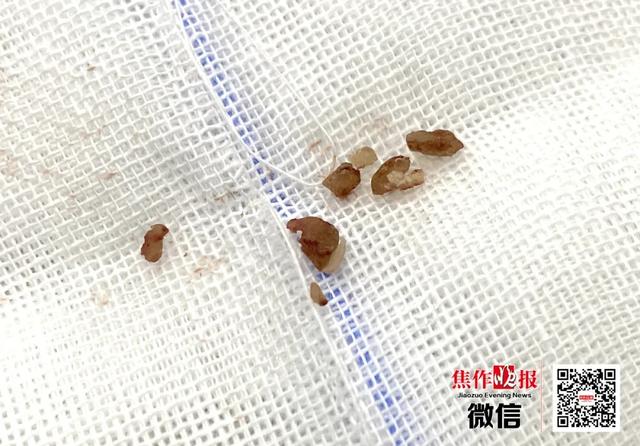 一岁半宝宝险些因它危及生命！罪魁祸首……