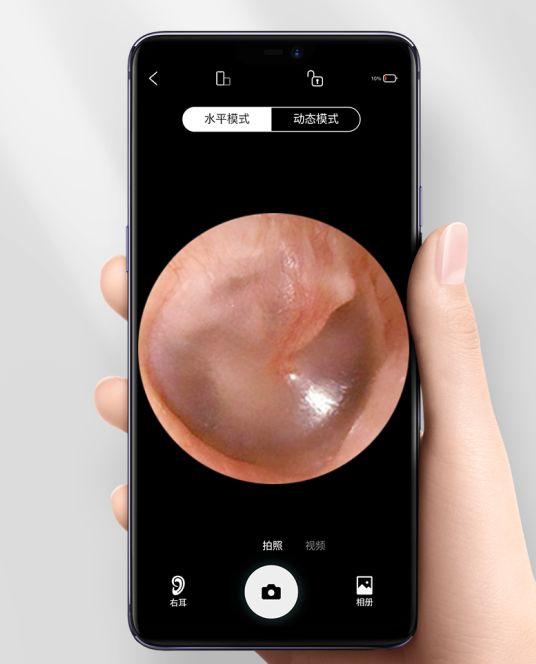 无人机技术做挖耳勺，500W像素超高清可视，换个头还能清痘！
