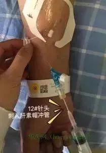 留置针引发新案件，你还敢这样做吗？