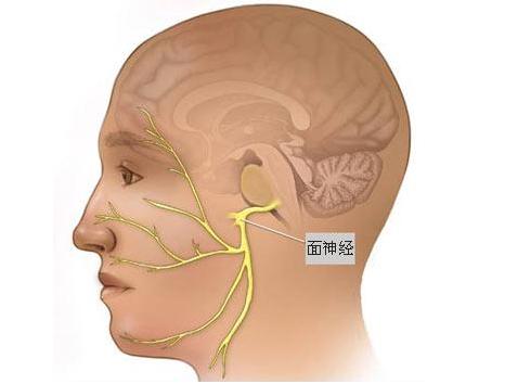 潍坊市人民医院专家提醒：不是所有的面部抽动都叫面肌痉挛