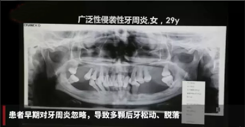 200元看牙消费券免费领，不限户籍，全城可领