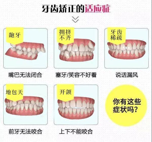 定了！北大口腔正畸博士限时0元看诊，龅牙、牙齿不齐、地包天、牙缝隙大的郑州市民赶紧预