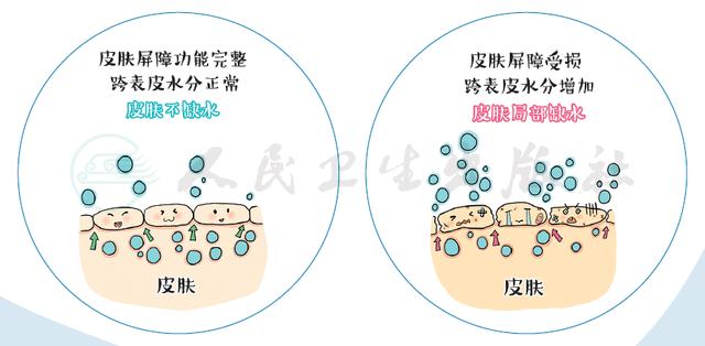 洗澡太勤也会生病吗？