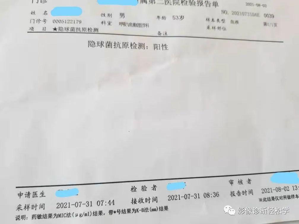 快快乐乐过大年 无难度学习肺隐球菌感染！