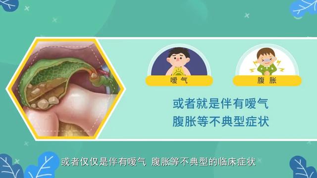 科普｜八桂中医大讲堂（28）：中医在胆石病的治疗中起什么作用