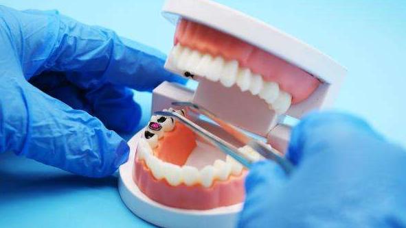 “种牙”纳入集采方案已成熟，网友：植发纳入医保还会远吗？