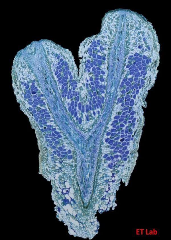 研究揭示沙棘放线菌固氮生物学机制