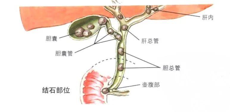 人到中年，左肝竟不翼而飞！是谁，悄悄偷走了肝脏？