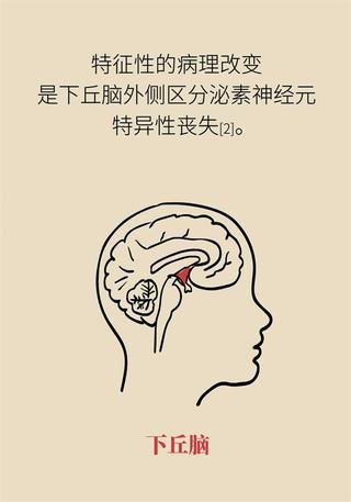 总是困倦睡不醒？当心患上发作性睡病