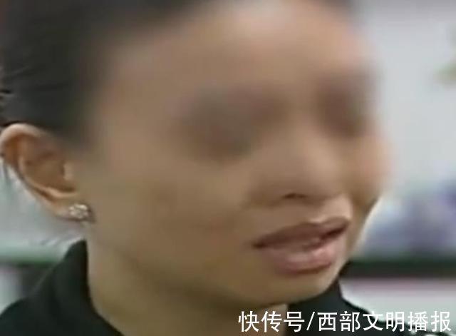 90岁老人两个月瘦成“骷髅”，孙女怀疑其受虐待，将叔叔告上法庭