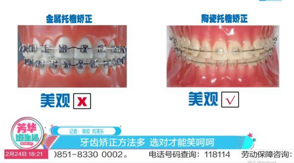 金属托槽、陶瓷托槽和隐形牙套，牙齿矫正方法多！分别有哪些优缺点？