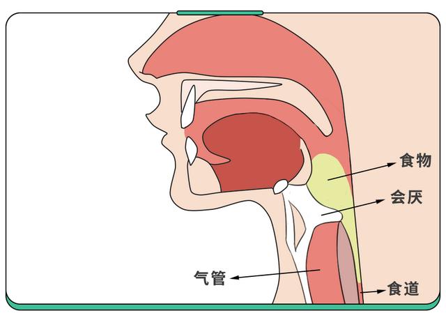 5岁娃嗓子疼进ICU！这病春季高发，重症率高，小孩大人都得防