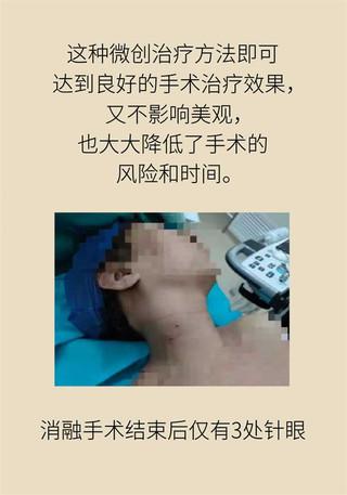 泌尿系统结石为啥要查甲状腺？听听专家怎么说