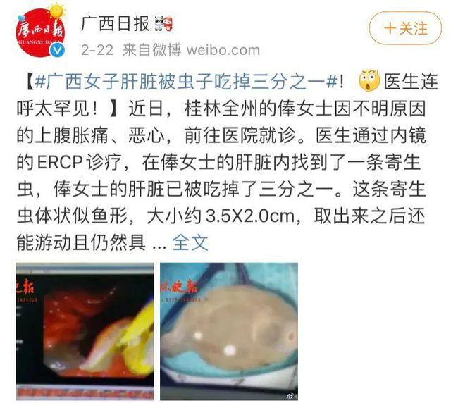 女子肝脏被寄生虫吃掉1/3，是因为吃了鱼腥草？！