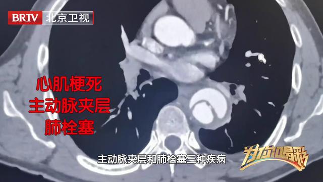 《为你喝彩》快速鉴别诊断胸痛元凶，为心血管病人寻找“心”希望