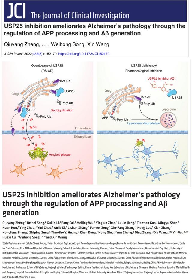瓯江实验室最新成果 发现阿尔茨海默病致病新机制及药物研发新靶点