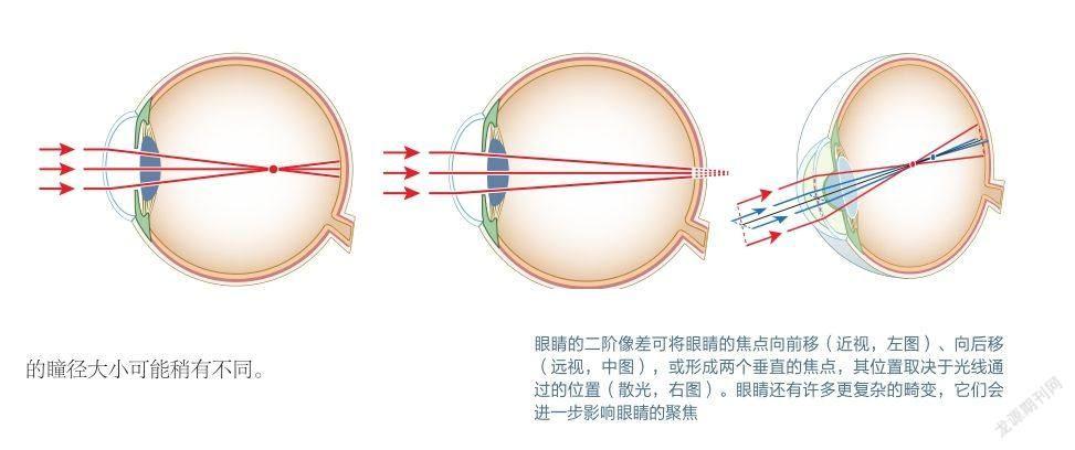 人眼与星空