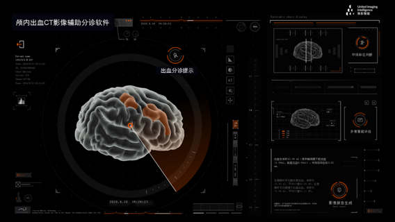 国内首款颅内出血CT影像辅助分诊软件获批