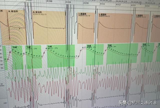 开着车，做着梦，醒来已追尾！随时随地犯困…这病差点要命