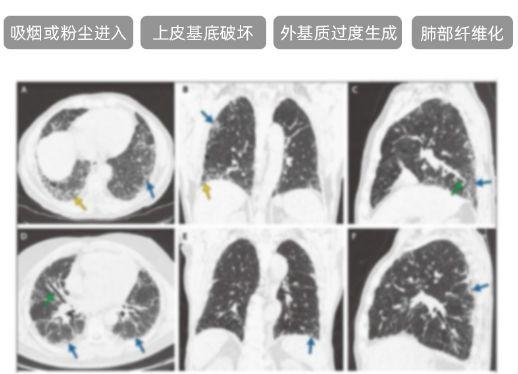 用嗓过度、咽痒咳嗽、工作乏累，怎么破？