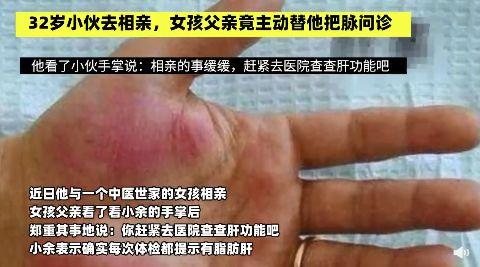 男子相亲被女方父亲发现有肝病，网友：做不成岳父认个干爹吧